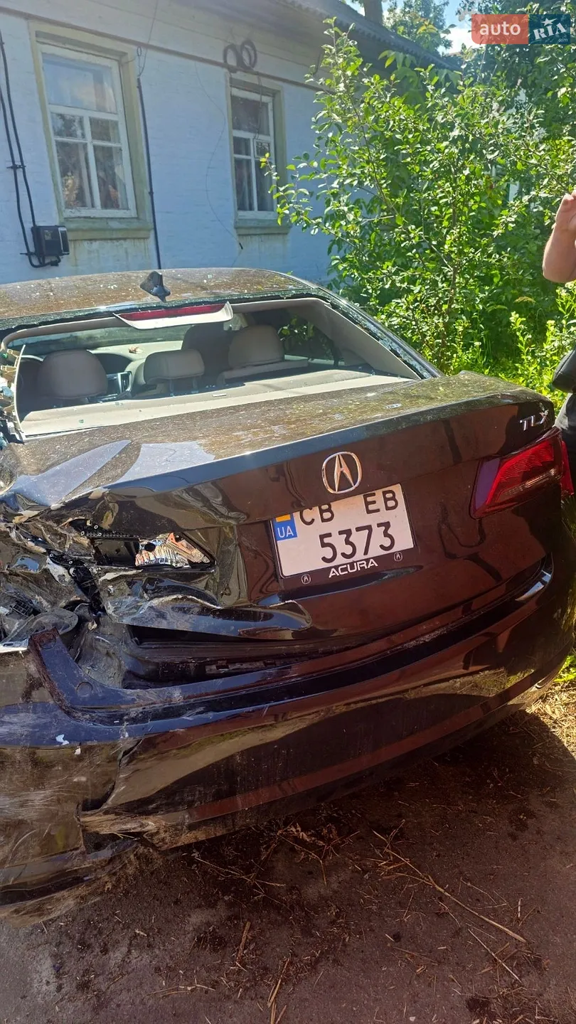 Acura TLX, 2016